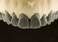 2. Bild / Kacinari Dental